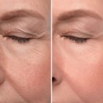 Anti Aging Eye Cream - Image 4